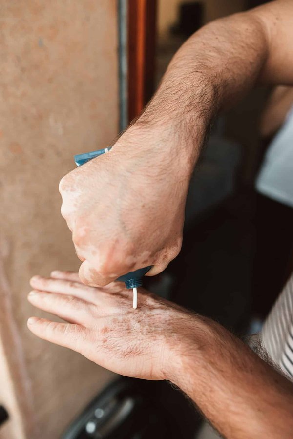 Tout savoir sur la dermatologie : conseils et solutions pratiques